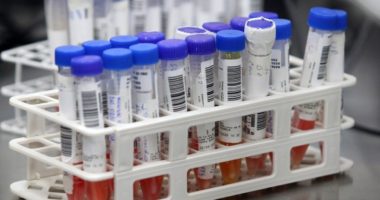 Artigo: Brasil registra 215 novas mortes por Covid-19 em 24 horas