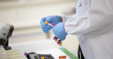 Artigo: Casos de Síndrome Respiratória Aguda devem crescer no Brasil