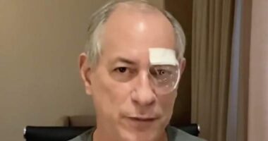 Artigo: Ciro Gomes avisa que passou por cirurgia nos olhos